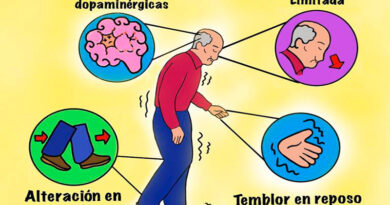 Parkinson, la segunda enfermedad neurodegenerativa más común 