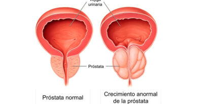 Una nueva era en el tratamiento del cáncer de próstata