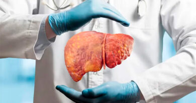 Identifican una nueva vía para potenciar la inmunoterapia contra el cáncer de hígado
